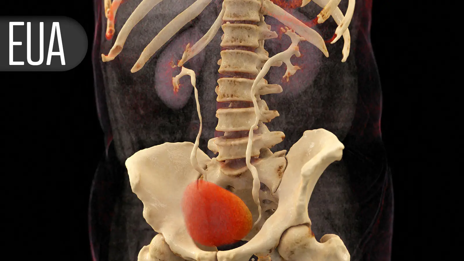 PSMA-PET Cuts Need for Biopsy in Suspected Prostate Cancer
