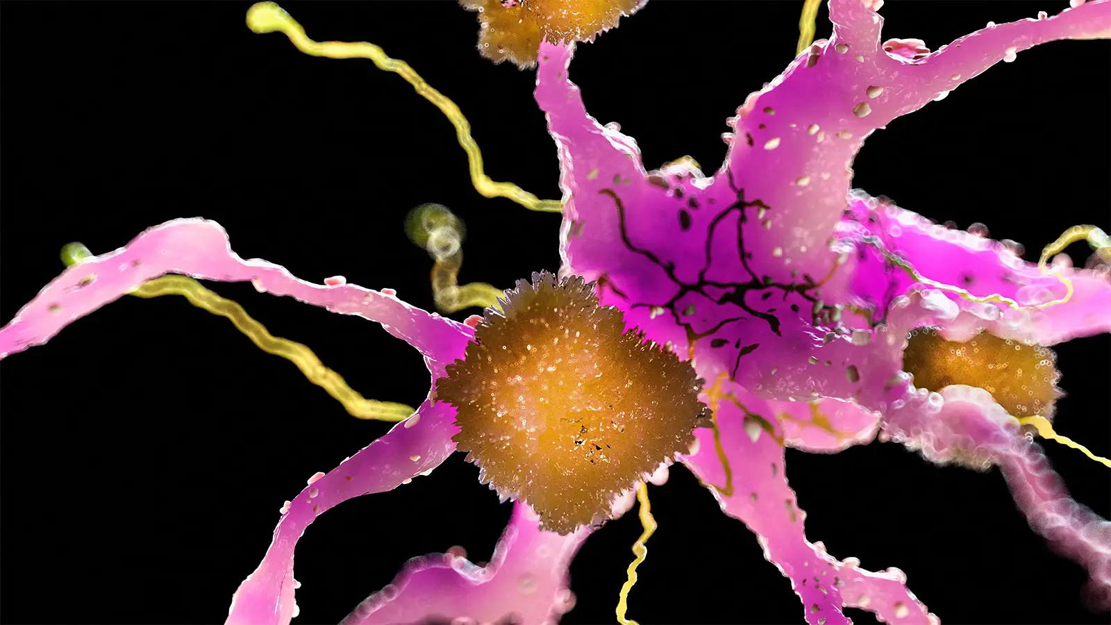 An Alzheimer's Revolution Is Coming, Experts Say