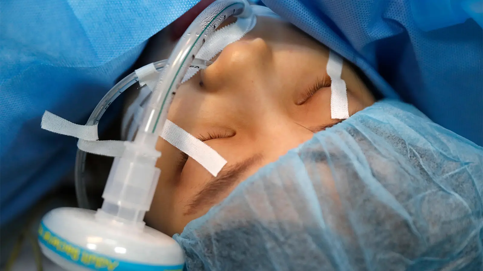 Child's 'Tail-Like' Limb Had to Be Surgically Removed