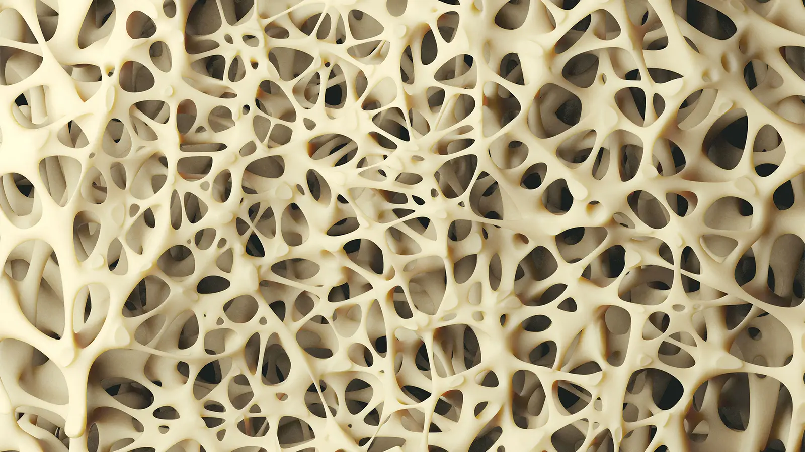 Can a Steroid Swap Protect Bone Health in Adrenal Insufficiency?