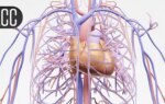 Pregnancy-Associated SCAD Is Often More Severe Yet Still Conservatively Managed