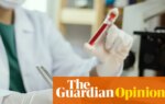 I was asked if there was an ‘everything’ test for cancer. Despite bold claims, no such thing exists | Ranjana Srivastava