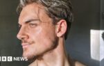 Inside the world of looksmaxxing