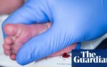 Scotland becomes first part of UK to screen newborns for spinal muscular atrophy | Scotland