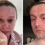 'Our skin is falling off and no-one can tell us why '