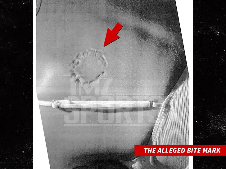 puka nacu Alleged Bite Injury tmzsports 1