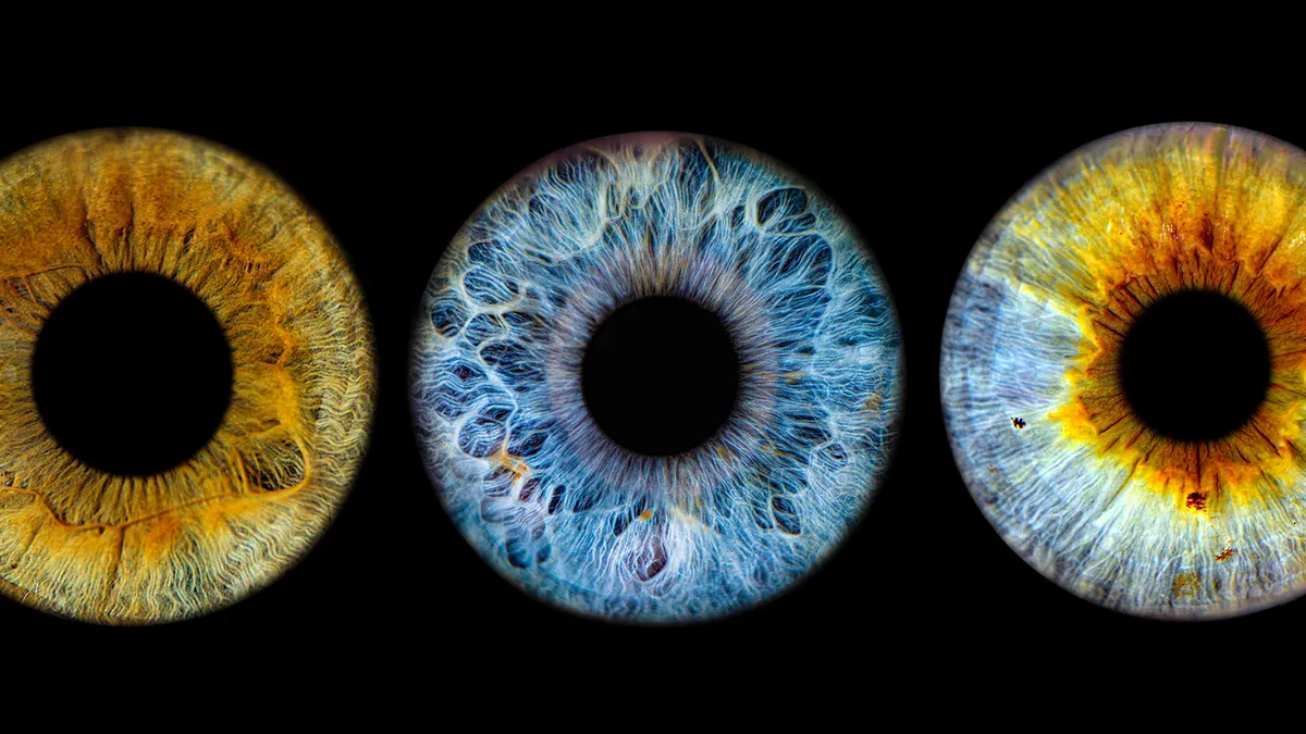 Eye Color: Percentage of the World Population With Each Shade