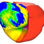 To Fix a Patient's Irregular Heartbeat, Doctors First Tested Its Digital 'Twin'