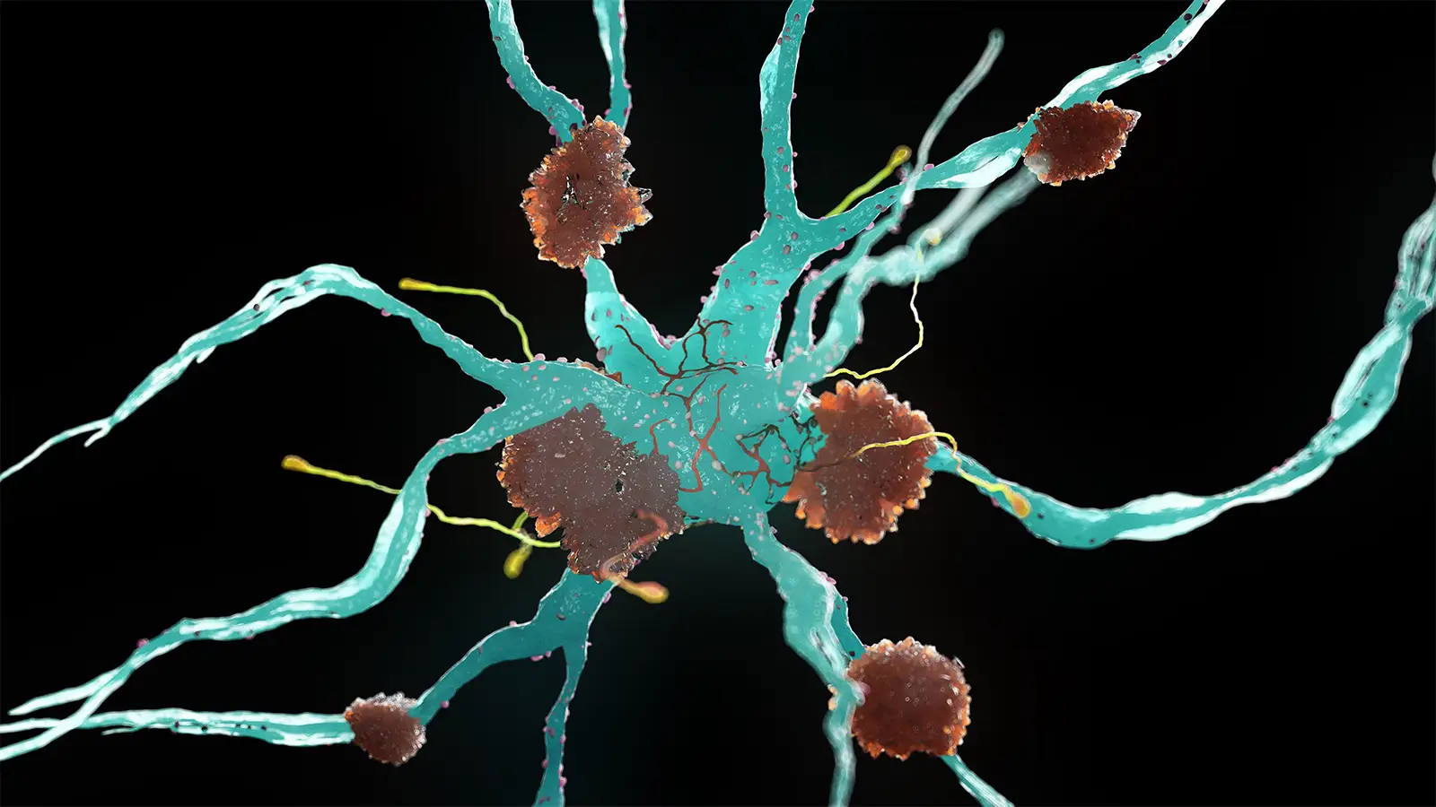 Alzheimer's Risk May Be Influenced by Flu Shots