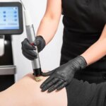 Is 'Butt Microneedling' the Secret to a Youthful Rear? Dermatologist Weighs In