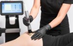 Is 'Butt Microneedling' the Secret to a Youthful Rear? Dermatologist Weighs In