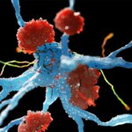 Alzheimer's Drug Review Ignites Backlash From Experts