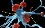 Alzheimer's Drug Review Ignites Backlash From Experts