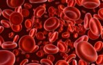 Low Hemoglobin Levels Linked to Higher Dementia Risk