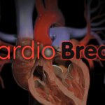 'Father of Modern Cardiology' Dies; Camzyos and Afib; Preeclampsia Blood Filtering