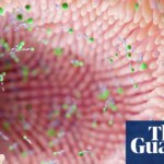 Gut microbiome can reveal risk of Parkinson’s, scientists say | Parkinson's disease