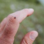 Five Common Mistakes People Make When Checking for Ticks