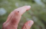 Five Common Mistakes People Make When Checking for Ticks