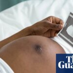 Stress from racism may help explain why black women more likely to die in childbirth, study finds | Women's health