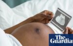 Stress from racism may help explain why black women more likely to die in childbirth, study finds | Women's health