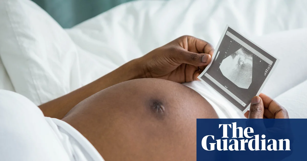 Stress from racism may help explain why black women more likely to die in childbirth, study finds | Women's health
