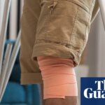 Knee surgery for cartilage damage does not benefit patients, study suggests | Medical research