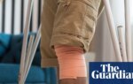 Knee surgery for cartilage damage does not benefit patients, study suggests | Medical research