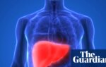 Raise tax on alcohol and junk food to cut deaths from liver disease, experts say | Health