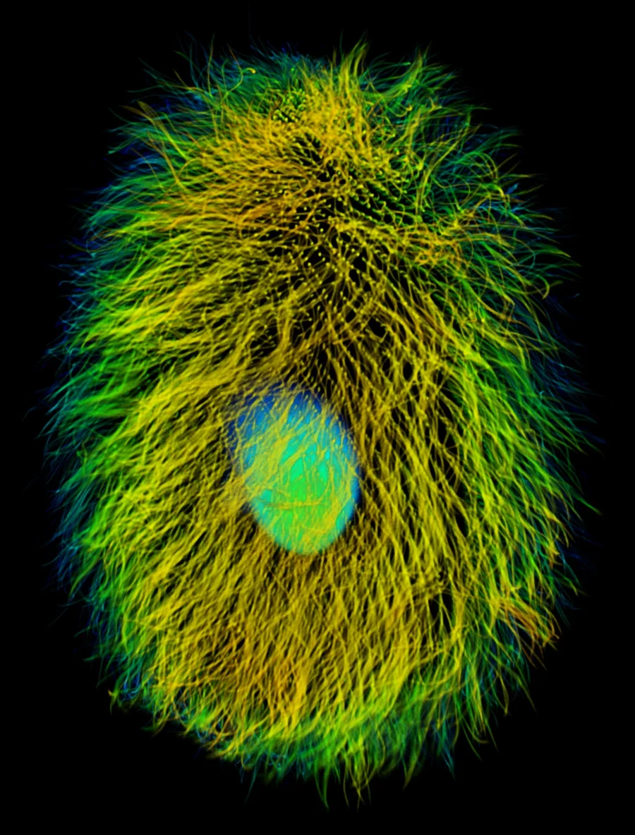 a green and "hairy" microbe