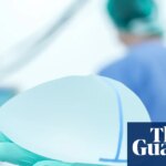 Breast reductions in UK overtake enlargements for first time, data shows | Plastic surgery