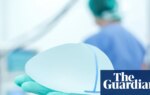 Breast reductions in UK overtake enlargements for first time, data shows | Plastic surgery