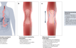 Esophagus engineering tackles function | Nature Biotechnology