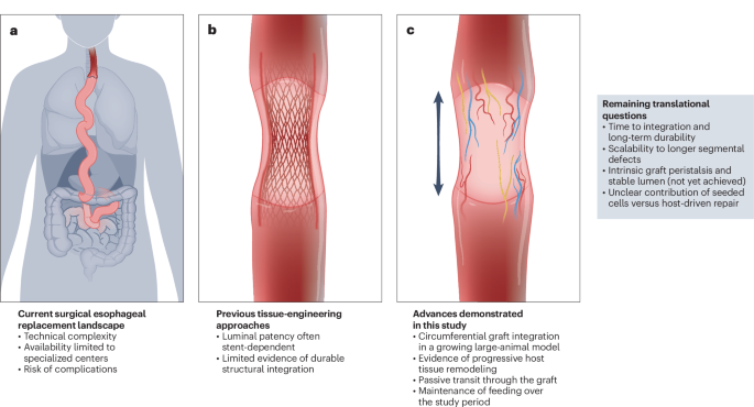 Esophagus engineering tackles function | Nature Biotechnology