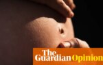 Why was a Florida woman forced to have a C-section? | Tayo Bero