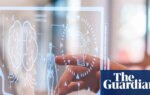 AI outperforms doctors in Harvard trial of emergency triage diagnoses | AI (artificial intelligence)