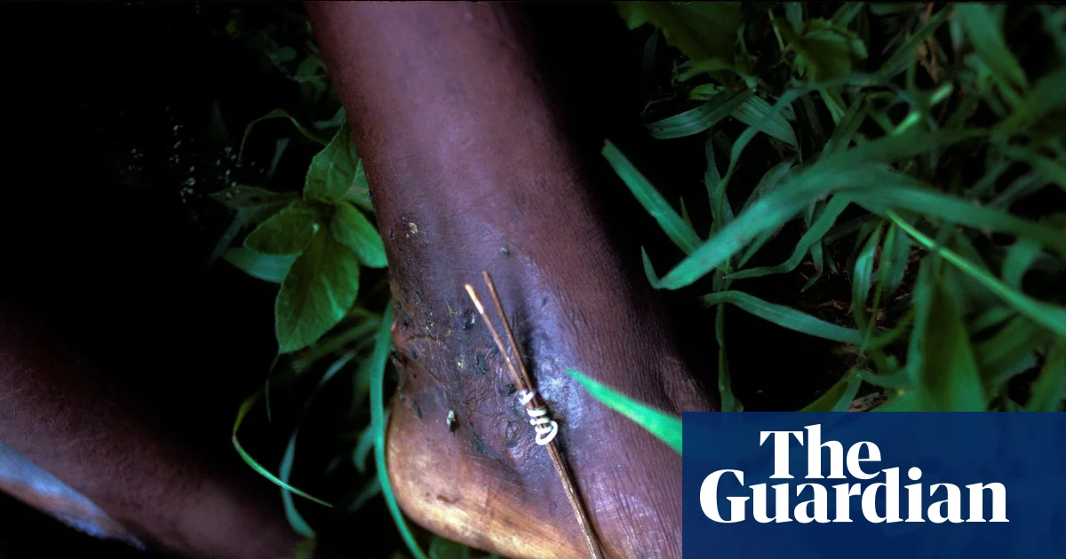 Can we eradicate a second human disease? – podcast | Science