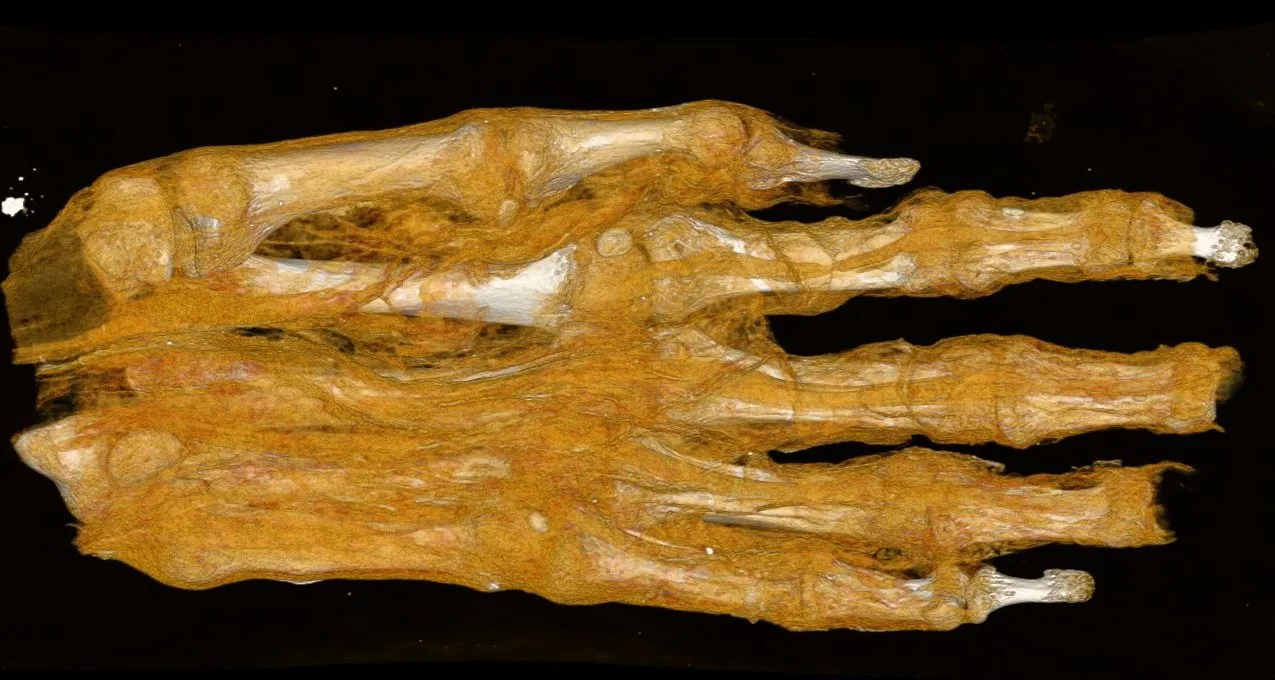 CT scan of mummy hand