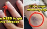 50 Doctors Share Health Signs You Should Never Ignore