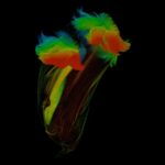 See the unexpected beauty in the microbes behind cow burps