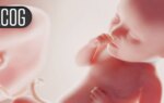 More Women Opted for Sterilization After Roe Fell
