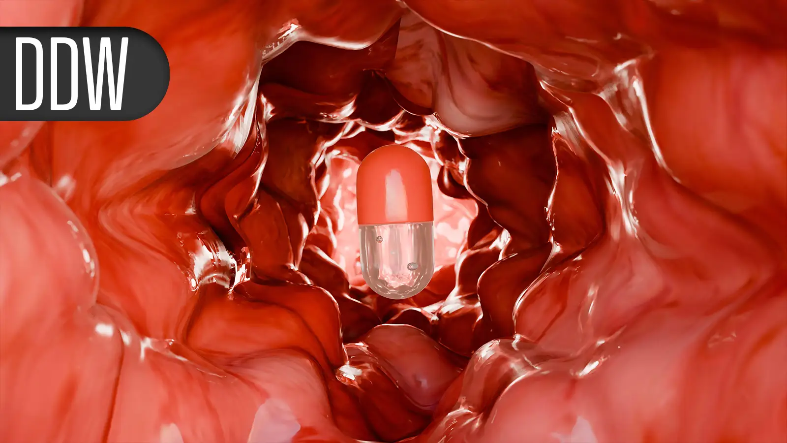 Colonoscopy Trial Highlights Strengths, Weaknesses in Benefits