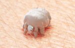 In Severe Scabies, Standard-Dose Ivermectin Superior to High Dose