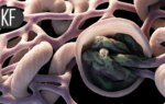 Big Gaps Between Heart Failure Patients' Goals and Clinical Reality, Survey Reveals