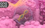 Prostate Cancer Drug Linked to Lower Risk of Cognitive Decline