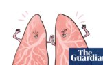Is it true that … your lungs regenerate when you quit smoking? | Health & wellbeing
