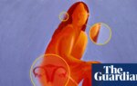 Can a name change transform PCOS outcomes for women? – podcast | Polyendocrine metabolic ovarian syndrome (PMOS)