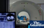 Weight gain as adult increases cancer risk by up to five times, research shows | Health
