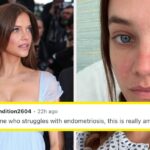 Barbara Palvin Pregnancy After Endometriosis Struggles