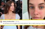 Barbara Palvin Pregnancy After Endometriosis Struggles