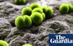 One dead and two more ill after meningitis outbreak in Berkshire | Meningitis